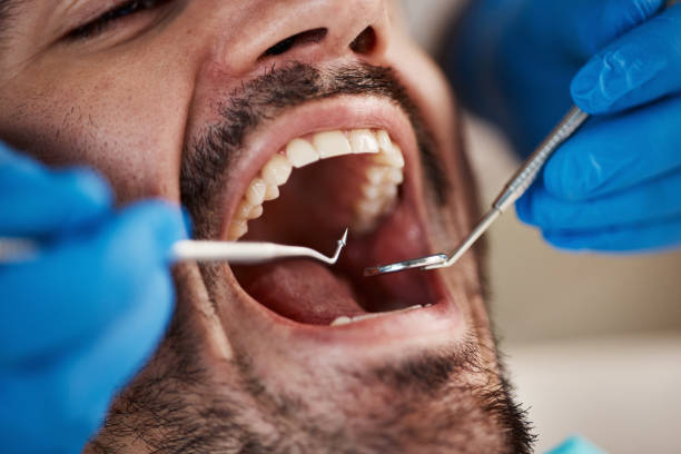 Best Walk-In Dentist Near Me  in Mec, CA